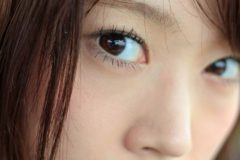 急な接近も怖くない！顔の産毛におすすめの脱毛法とは