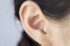 結構ふわふわ？どうしてますか、耳たぶ・耳の周りの産毛